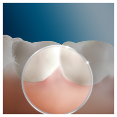 ORAL-B OXYJET szájzuhany, mikrobuborékos, 5 üzemmód, 4  vízsugár, fogínybetségre, fogszabályzó, hid, korona tisztításra